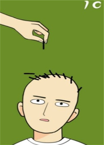 琦玉老师植发.jpg 琦玉老师植发.jpg